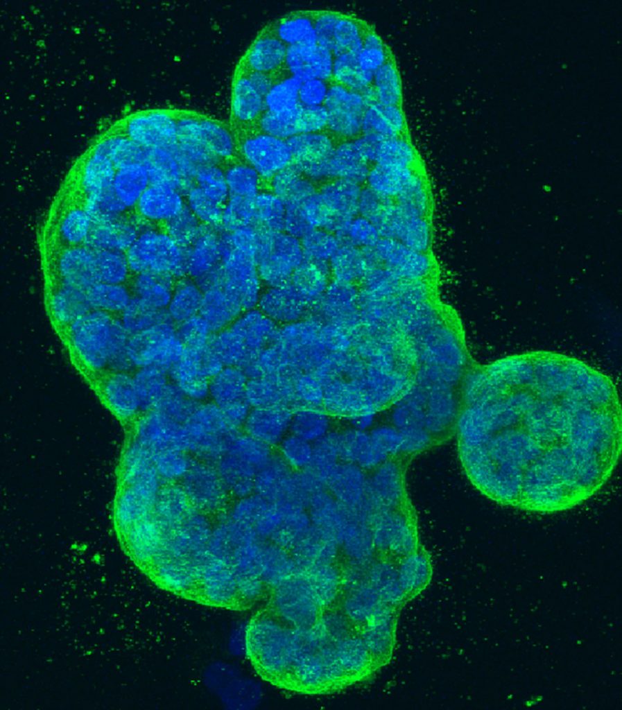 membrana proteinskog omotača kancerogena ćelija