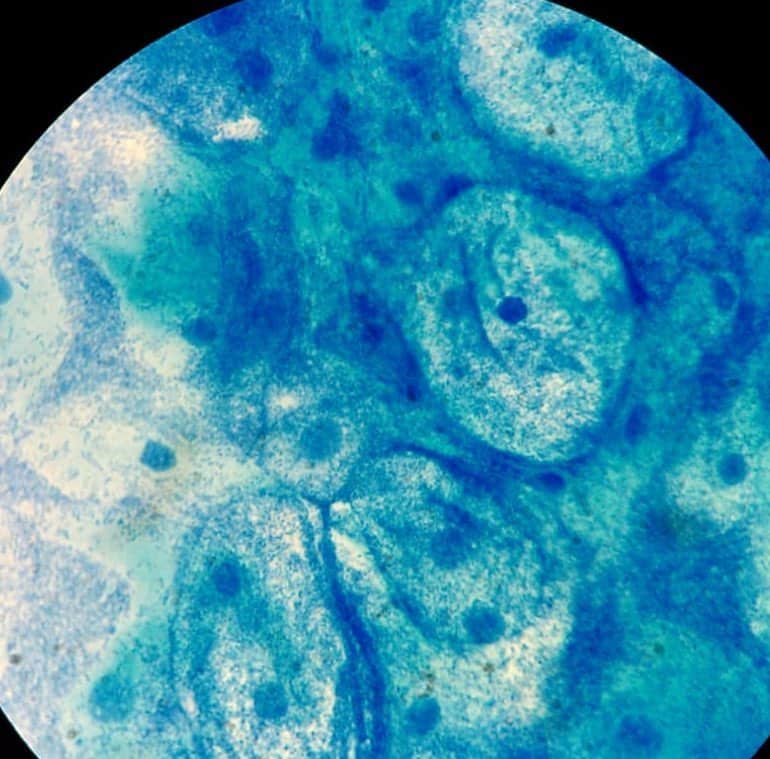 mikrobi uveličana slika