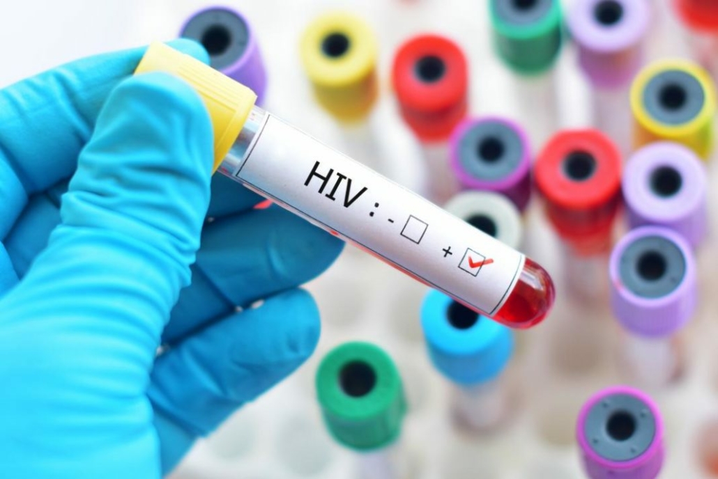 Liječenje HIV-a