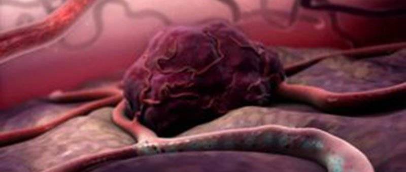 razvoj krvnih sudova tumor
