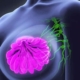 svest o raku dojke