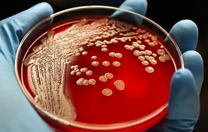 Stafilokokne bakterije