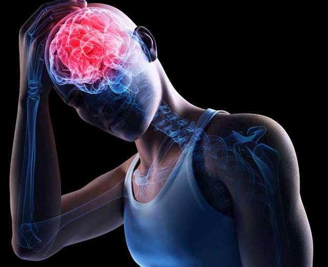 Što je moždani udar i kako ga možete spriječiti?