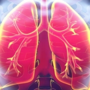 pulmonary tuberculosis picture main