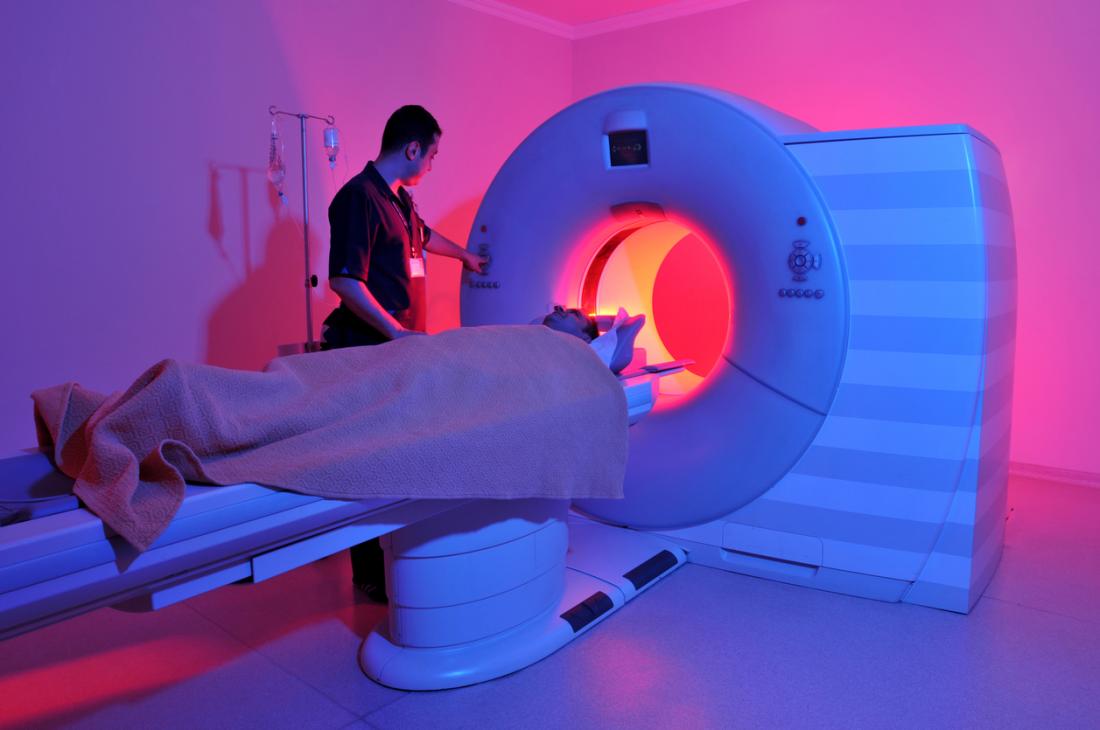 MRI magnetna rezonanca