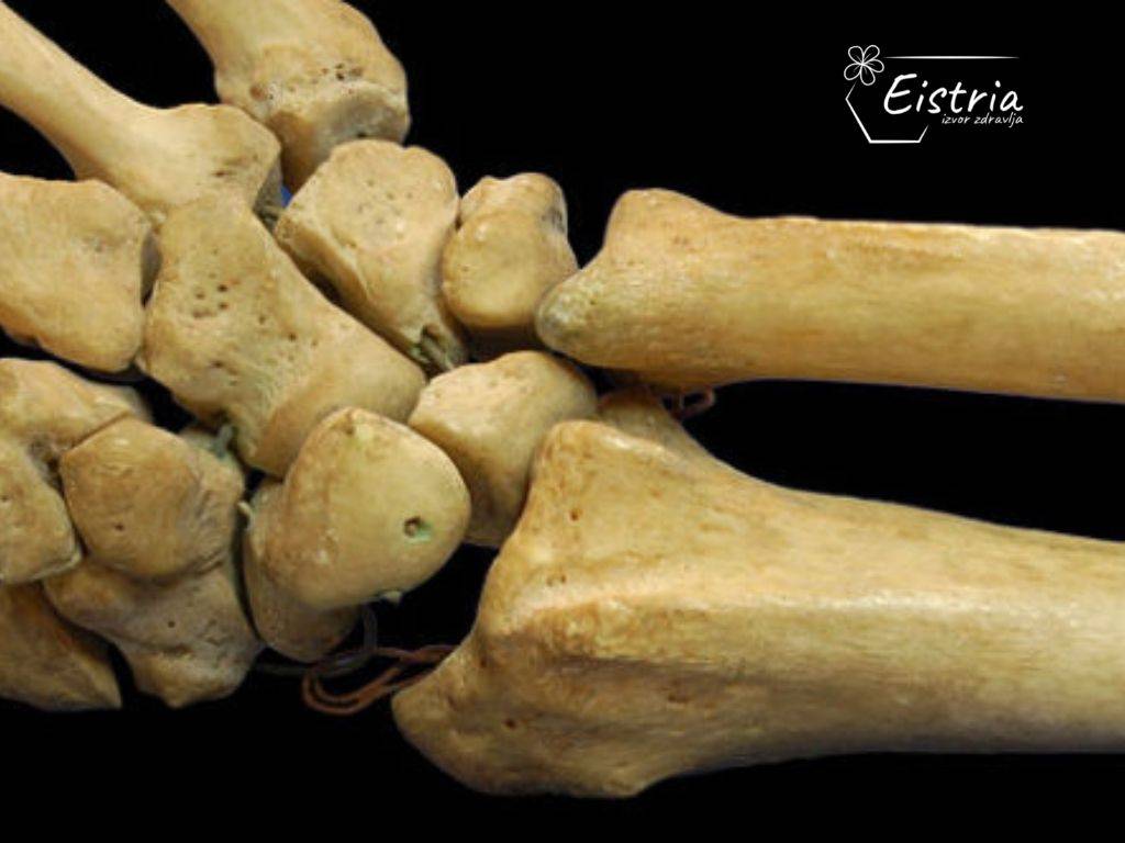 kosti osteoporoza