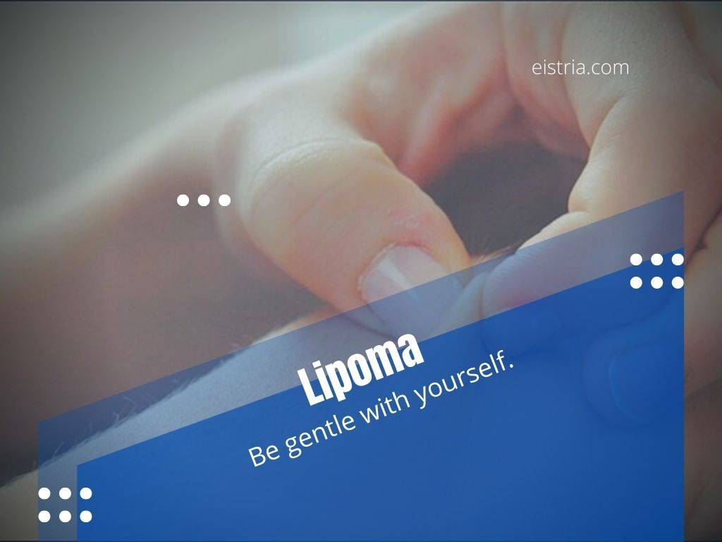 Lipoma natural treatment.com
