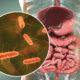 intestinal microbiome, escherichia coli